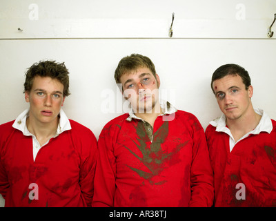 Bruised rugby players Stock Photo