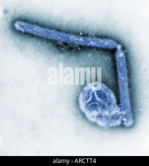 transmission electron micrograph (TEM), magnification of 108,000x, reveals the ultrastructural details of two avian influenza Stock Photo