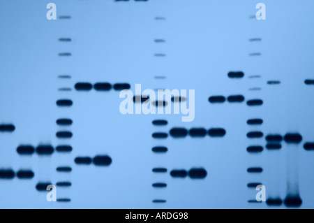 Autoradiograph "DNA fingerprints" of a variety of DNA samples. Stock Photo