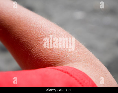 Goose bumps with raised hairs on skin caused by cold weather on forearm Stock Photo