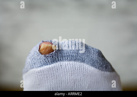 toe protruding through hole in worn out sock Stock Photo
