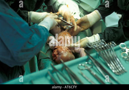 childbirth in hospital Stock Photo