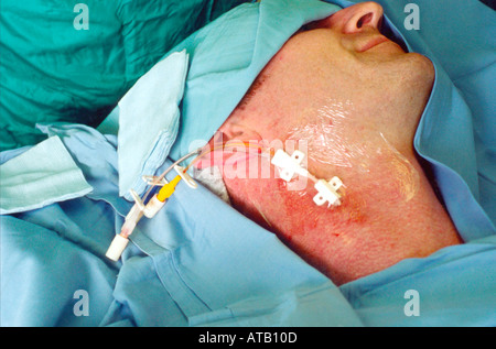 Central venous line CVP insertion Stock Photo