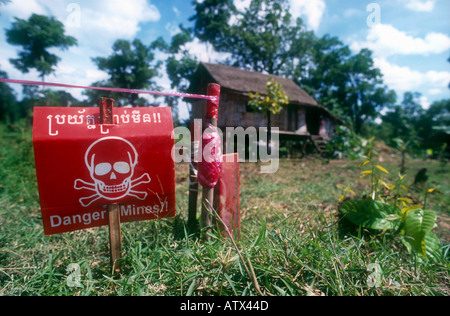 Land mines remain the brutal legacy of years of war in Cambodia. Stock Photo