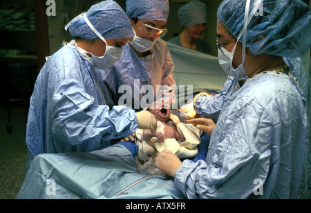 Operating theatre  performing a caesarean birth. Stock Photo