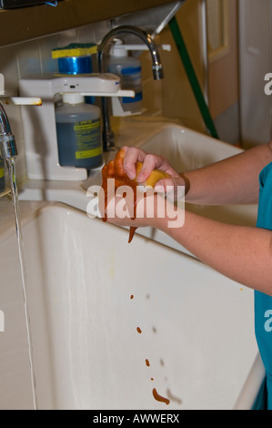 Surgical Hand Scrub Stock Photo