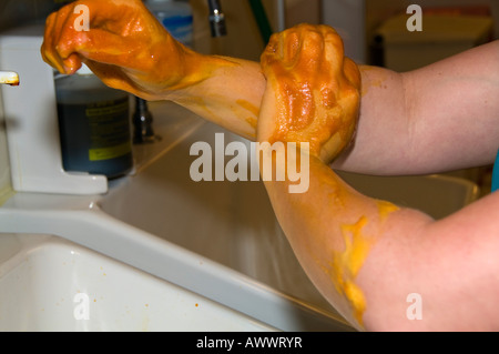 Surgical Hand Scrub Stock Photo