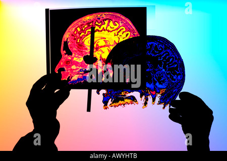 medical technician comparing two color transparencies of  human skull  x-rays Stock Photo