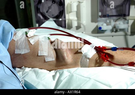 A female Patient on Haemodialysis Stock Photo