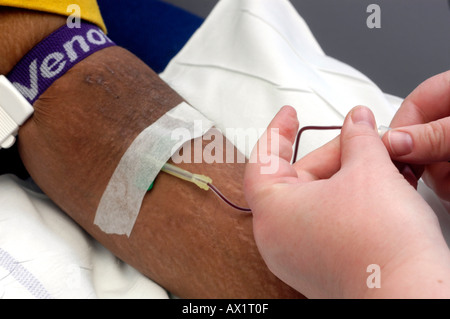 Patient having butterfly inserted into vein Stock Photo