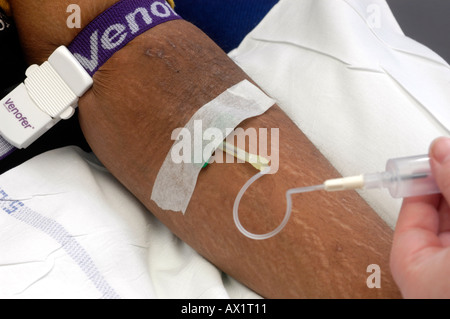 Patient having butterfly inserted into vein Stock Photo