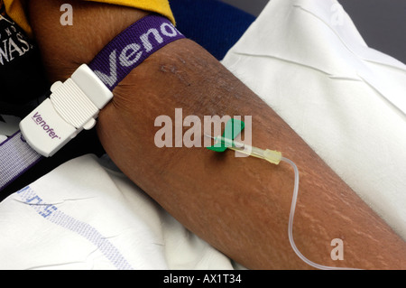 Patient having butterfly inserted into vein Stock Photo