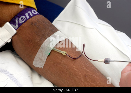 Patient having butterfly inserted into vein Stock Photo