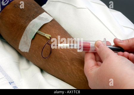 Patient having butterfly inserted into vein Stock Photo