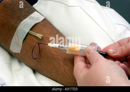 Patient having butterfly inserted into vein Stock Photo