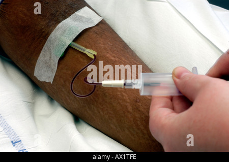 Patient having butterfly inserted into vein Stock Photo