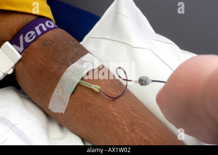 Patient having butterfly inserted into vein Stock Photo