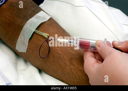 Patient having butterfly inserted into vein Stock Photo