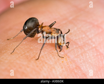 Wood ant bites deposits formic acid on human Stock Photo - Alamy