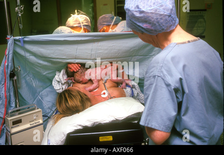 Newborn baby bonding with mother after caesarian birth. Stock Photo
