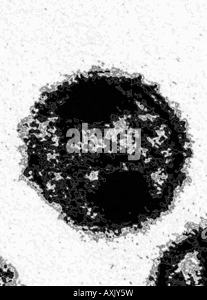 HIV virus AIDS virus as seen through EM microscope Stock Photo - Alamy