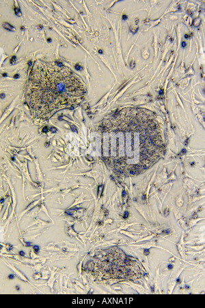 human embryonal stem cell as seen through light microscope Stock Photo