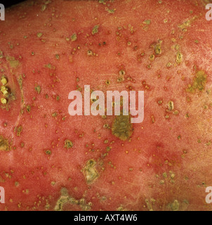 Potato cyst nematode Heterodera spp feeding damage to potato tuber surface Stock Photo