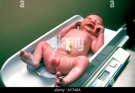 Crying newborn baby being weighed. Stock Photo