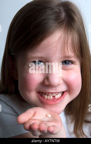 Litlle girl holding her missing tooth Stock Photo
