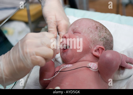 A 5 weeks premature baby is being cleaned of his secretion by the neonatality nurses minutes after being born Stock Photo
