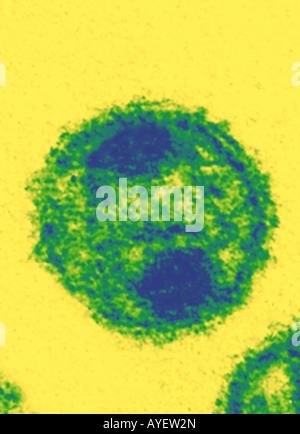 HIV virus AIDS virus as seen through EM microscope Stock Photo - Alamy