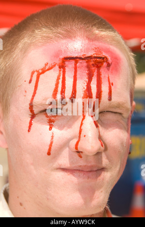 fake head wound Stock Photo: 17182813 - Alamy