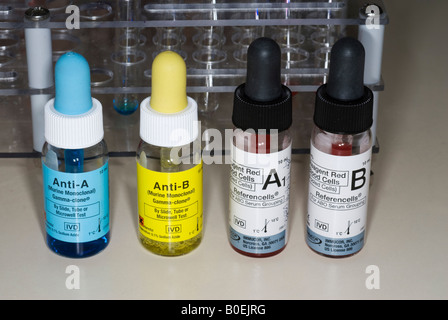 Blood bank reagents used for determination of blood type in the laboratory Stock Photo