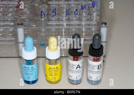 Blood bank reagents used for determination of blood type in the laboratory Stock Photo