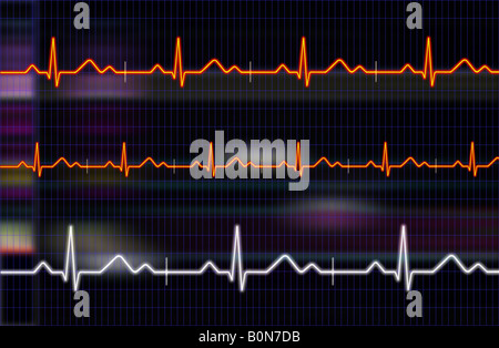 Electrocardiogram conceptual background Stock Photo
