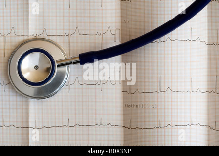 Close up of an electrocardiograph and a stethoscope Stock Photo