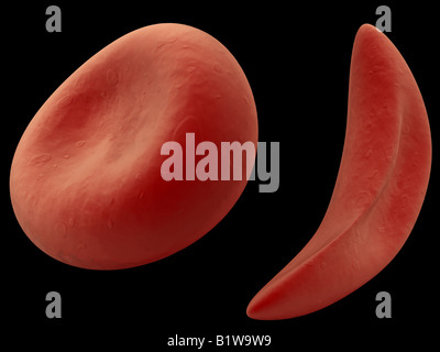 sickle cells Stock Photo