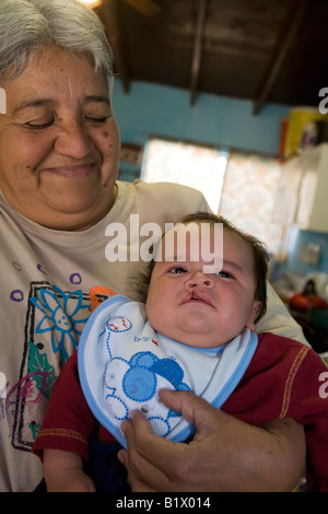 Nogales Sonora Mexico A grandmother holds a baby with a cleft palate Stock Photo