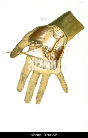 ILLUSTRATION DISSECTION OF HAND ARTERY NERVES TENDONS Stock Photo