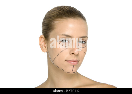 Young woman with plastic surgery markings on face, looking at camera Stock Photo