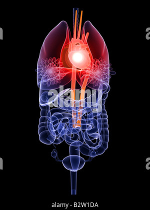 heart attack Stock Photo