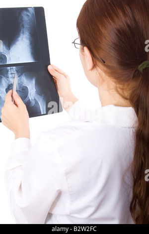 Female doctor examining a pelvis x-ray Stock Photo