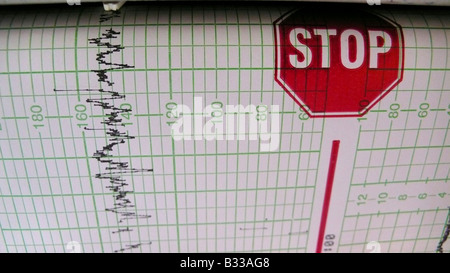 CTG, cardiotocograph Stock Photo