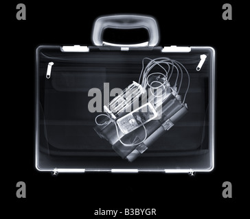 X-ray of a bag containing a bomb Stock Photo