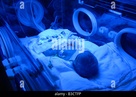 A premature baby inside incubator device at the neonatal intensive care unit in Shaare Zedek Medical Center or Shaarei Tzedek hospital, West Jerusalem Stock Photo
