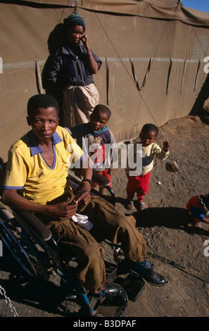 Disabled man at the Schmidtsdrift camp in Northern Cape, South Africa. Stock Photo