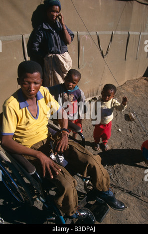 Disabled man at the Schmidtsdrift camp in Northern Cape, South Africa. Stock Photo