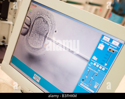 Monitor showing an intra cytoplasmic sperm injection (selective focus) Stock Photo