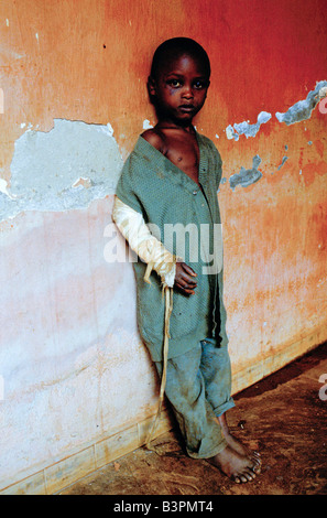 BURUNDI'S ETHNIC STRIFE', NOV 1993.  KERIMBA HOSPITAL, BUWERU PROVINCE. WOUNDED CHILD Stock Photo