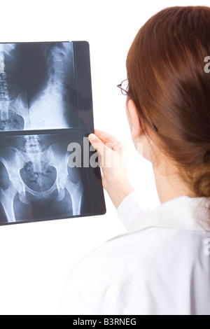 Female doctor examining a pelvis x-ray Stock Photo